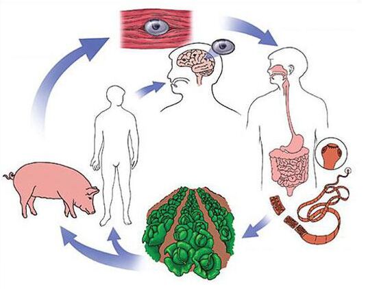 infection